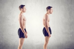 Upper Crossed Syndrome Boca Raton