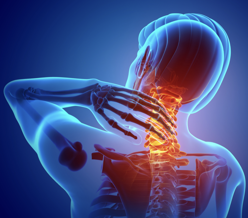 Symptoms of Cervical Discogenic Pain Syndrome